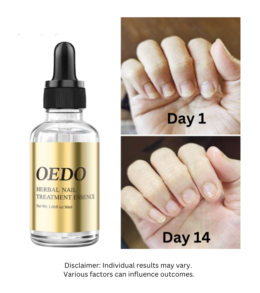 OEDO™: Herbal Nail Essence—Extended Sale Ends Midnight