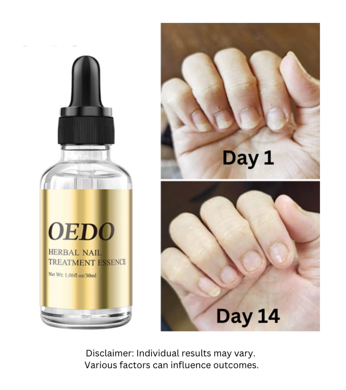 OEDO™ Herbal Nail Essence - Late Stage Fungus (4x)